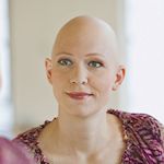 Kundin H. ohne Perücke (Glatze)