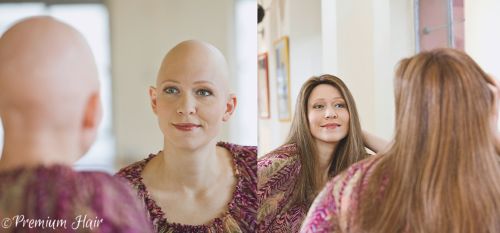 Hübsche Frau mit Glatze: Ohne und mit  Echthaarperücke